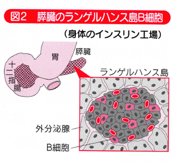 1型糖尿病とその治療 | 佐賀駅南クリニック