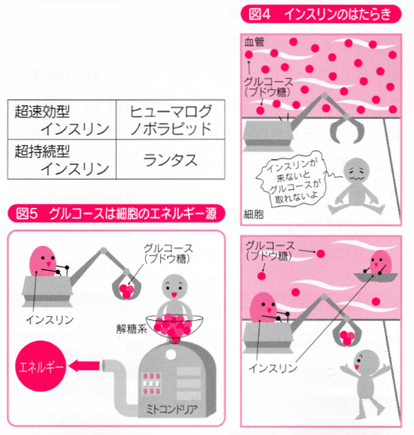 1型糖尿病とその治療 佐賀駅南クリニック